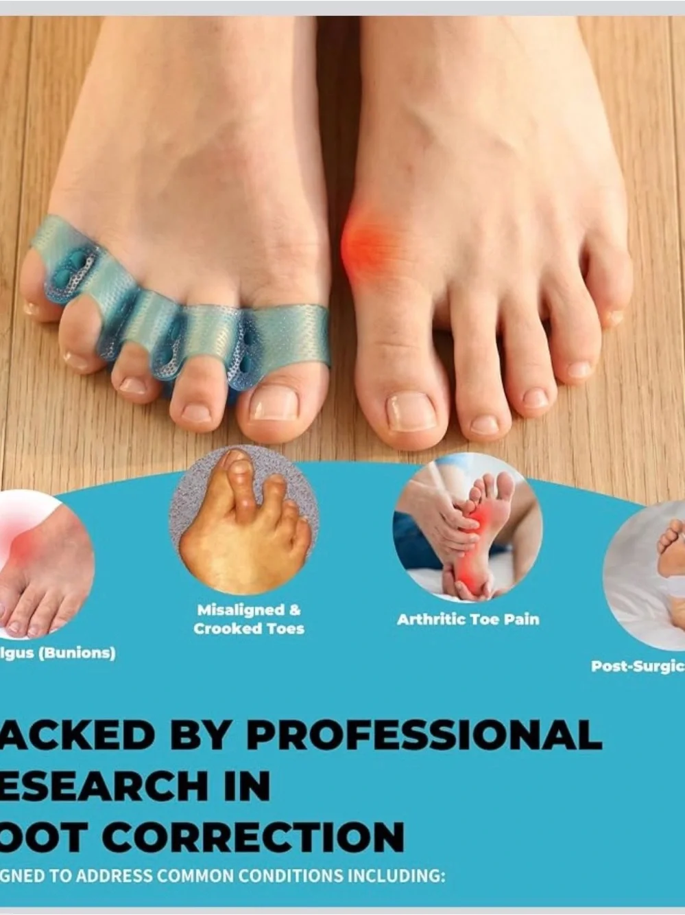 Toe Separators